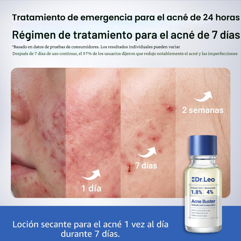 Dr. Leo Suero Secante para el Acné